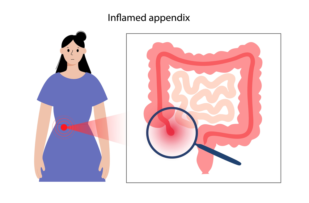Appendix