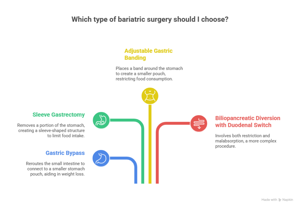 types of bariatric surgery