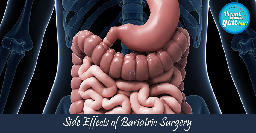 bariatric surgery complications