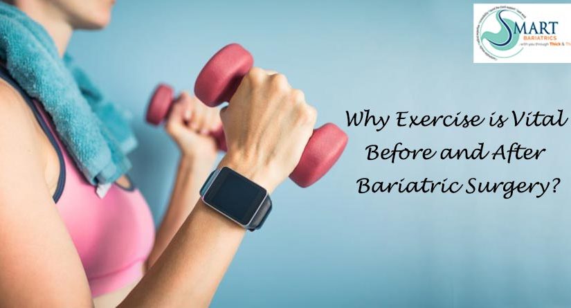 Why Exercise is Vital Before and After Bariatric Surgery?