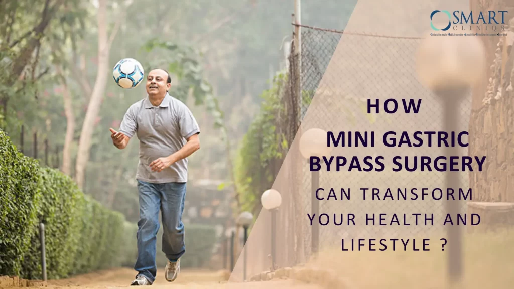 How Mini Gastric Bypass Surgery Can Transform Your Health and Lifestyle