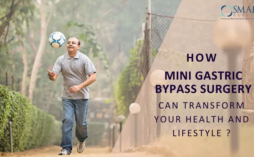 How Mini Gastric Bypass Surgery Can Transform Your Health and Lifestyle