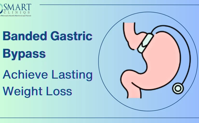 Banded Gastric Bypass Achieve Lasting Weight Loss