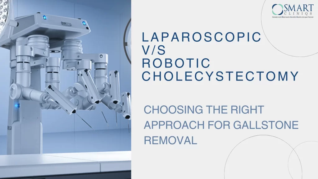 Laparoscopic vs Robotic Cholecystectomy: Choosing the Right Approach for Gallstone Removal