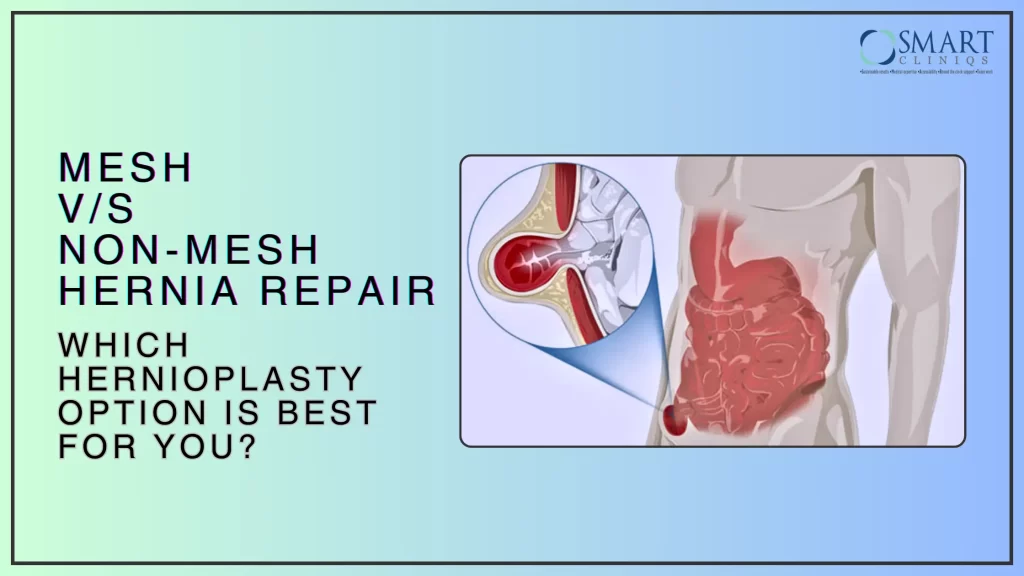 Mesh v/s Non-Mesh Hernia Repair : Which Hernioplasty Option is Best for You?