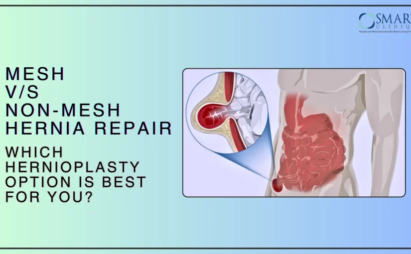 Mesh vs. Non-Mesh Hernia Repair