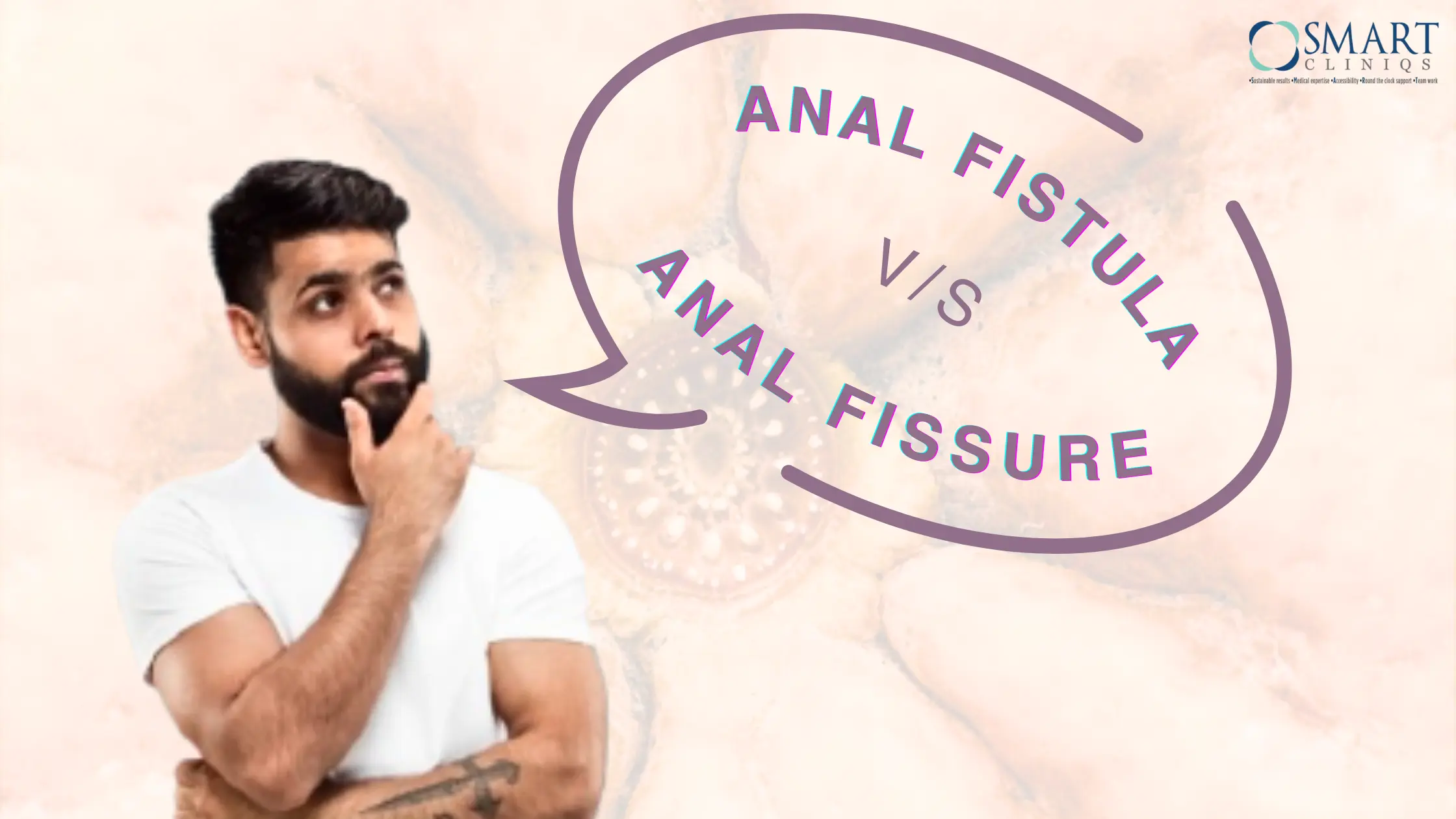 Anal fistula vs anal fissure